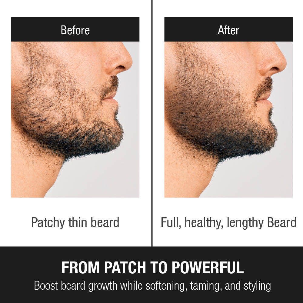 Red by Kiss Groomane Beard Growth Oil