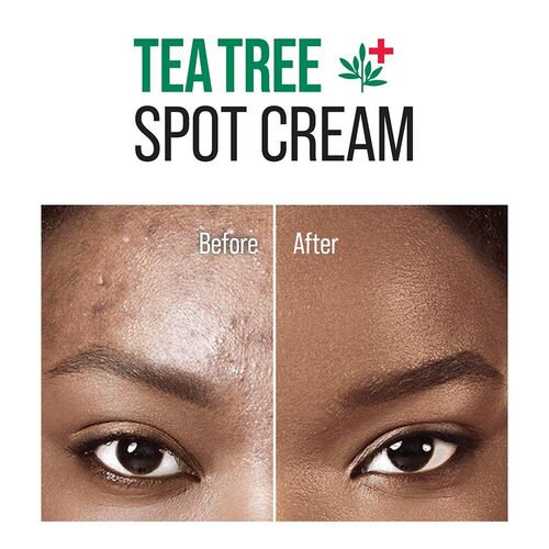 KISS Tea Tree Oil Spot Cream (TT03)
